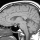 Illustration for article titled How MRIs work